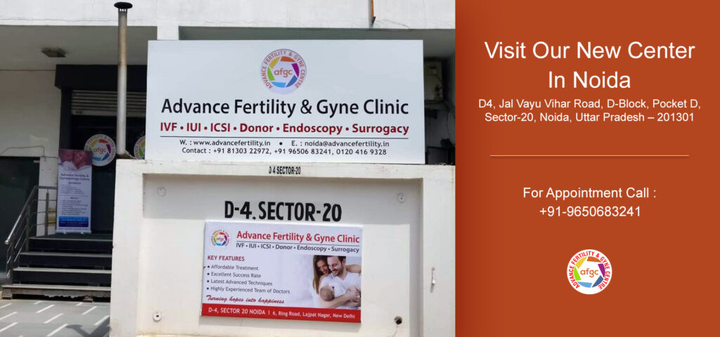 Best IVF Clinic in Noida