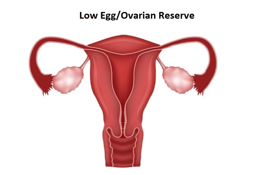 Low Egg/Overian Reserve