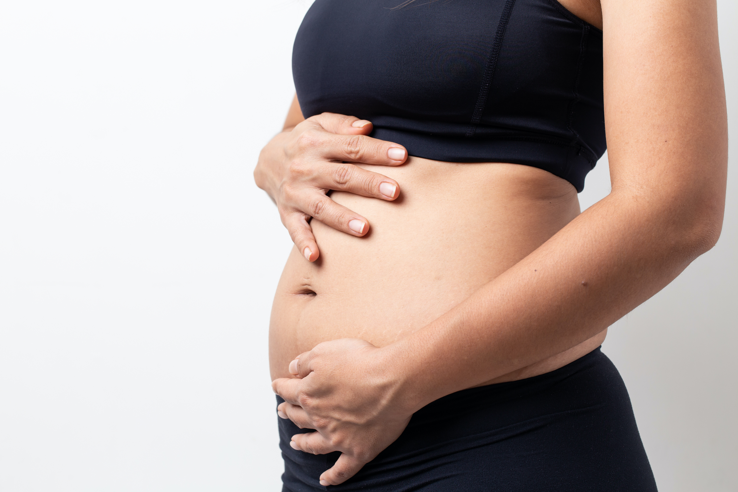 Close-up of a woman's abdomen with a fibroid